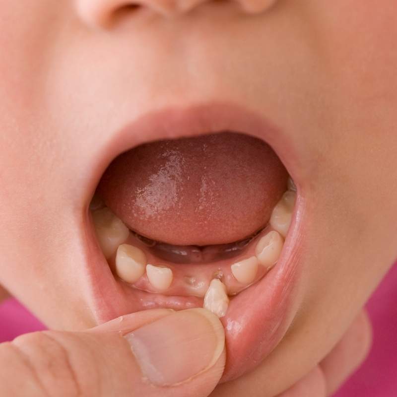 7 yaş kalıcı dişin sallanması