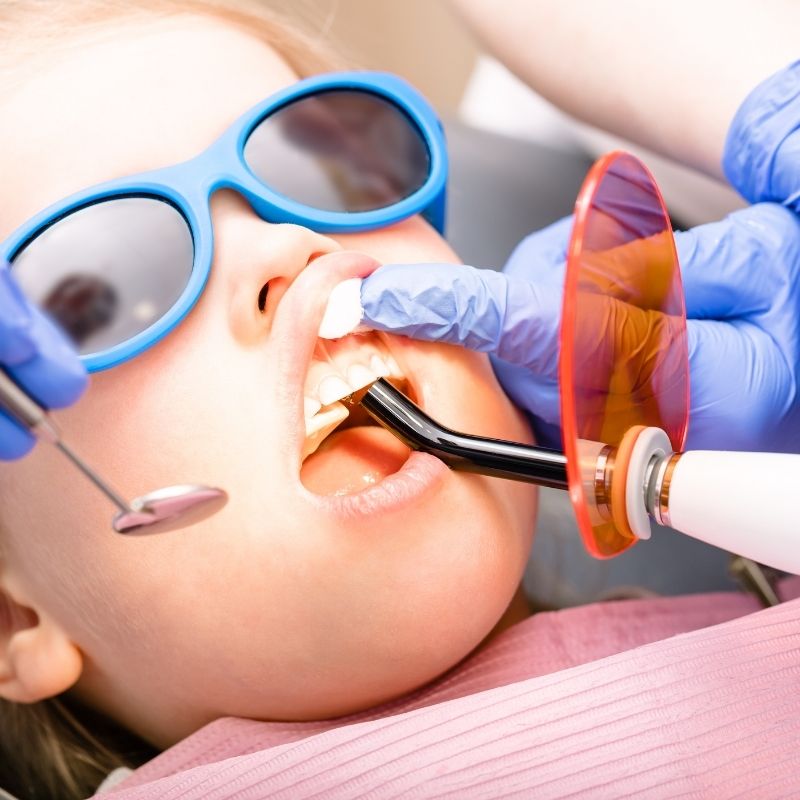 diş dolgusu çeşitleri