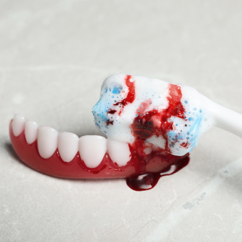 Durduk yere diş eti kanaması Durduk yere diş eti kanaması