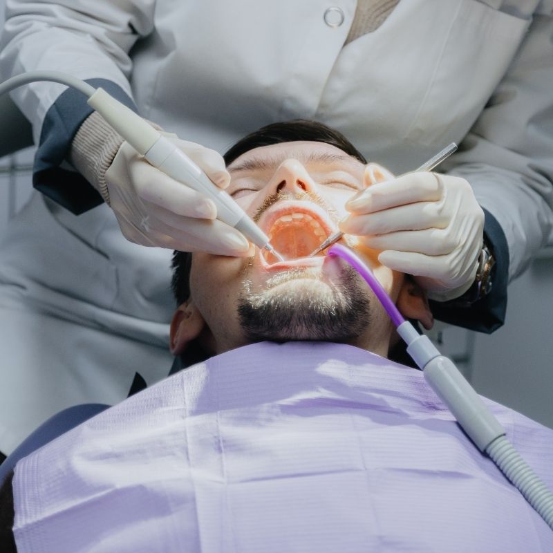 Diş taşı temizliği