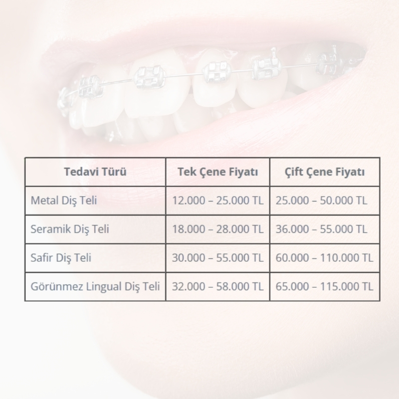 Diş teli fiyatları ne kadar Diş teli fiyatları ne kadar