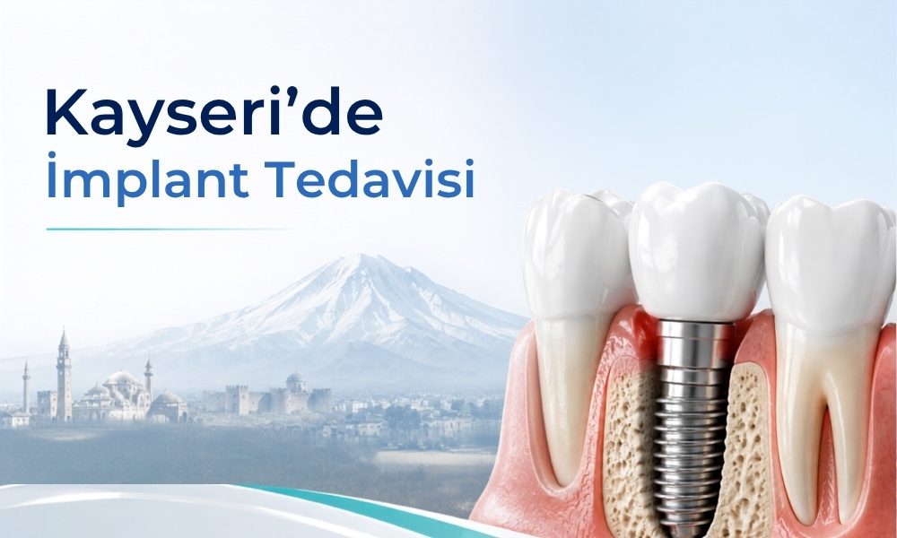 Kayseri’de İmplant Tedavisi