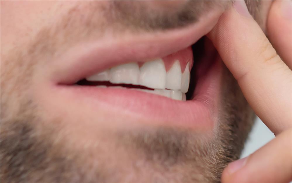 Diş Eti Şişmesi Diş Eti Şişmesi