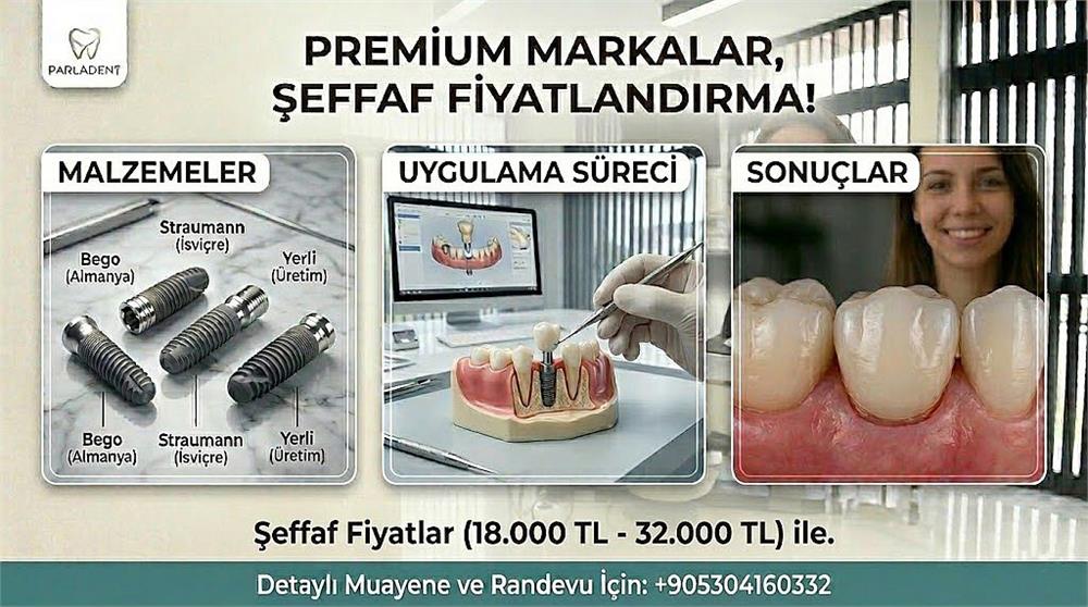 Tek Diş Implant Fiyatı 2026 Tek Diş Implant Fiyatı 2026