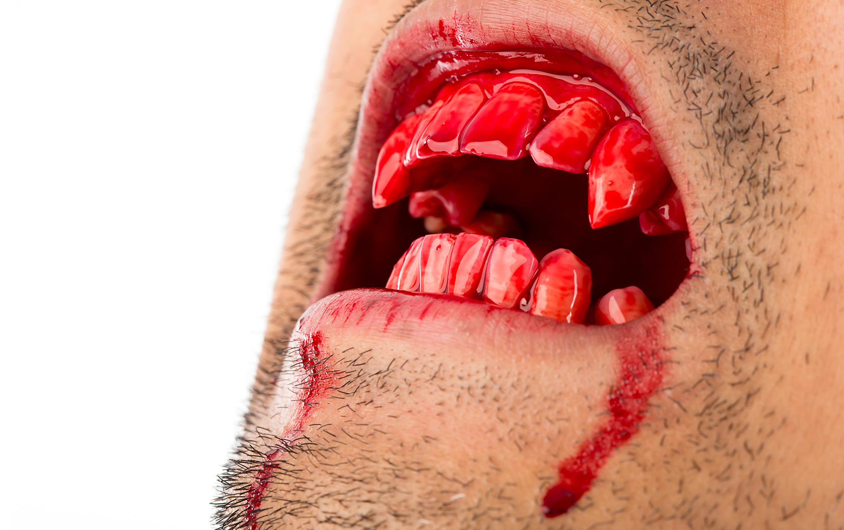 Diş Çekimi Sonrası Kanama