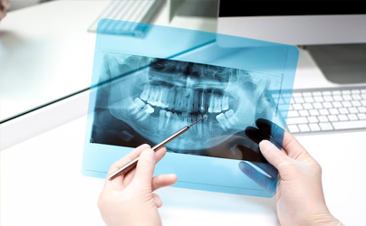 Oral Diagnosis: A Vital Step for Optimal Oral Health